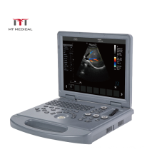 Medical Ultrasound Instruments 3D/4D Color Doppler Portable Ultrasound Scanner Price